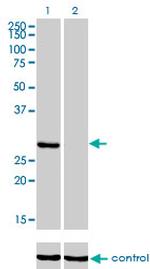 KHK Antibody in Western Blot (WB)