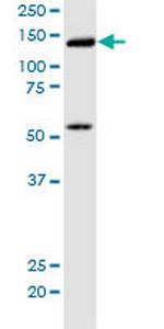 KIF5B Antibody in Western Blot (WB)