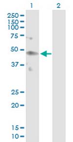 KIR2DL4 Antibody in Western Blot (WB)