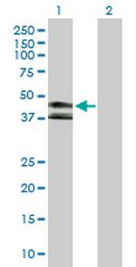 KIR3DL1 Antibody in Western Blot (WB)