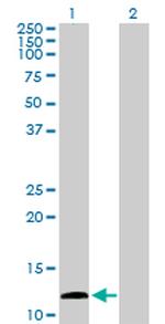 KISS1 Antibody in Western Blot (WB)