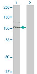 KIT Antibody in Western Blot (WB)