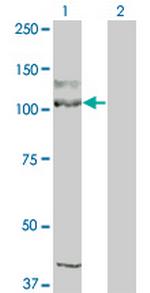 KIT Antibody in Western Blot (WB)