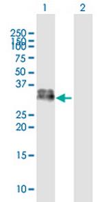 KLK1 Antibody in Western Blot (WB)