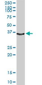 KLK1 Antibody in Western Blot (WB)