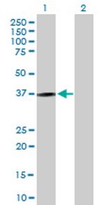 KLRC1 Antibody in Western Blot (WB)