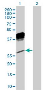 KLRC1 Antibody in Western Blot (WB)