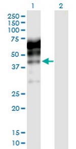 KNG1 Antibody in Western Blot (WB)