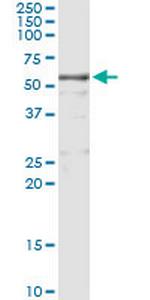 KNG1 Antibody in Immunoprecipitation (IP)