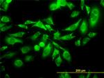 KIFC1 Antibody in Immunocytochemistry (ICC/IF)