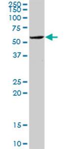 KPNA1 Antibody in Western Blot (WB)