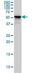 KRT4 Antibody in Western Blot (WB)