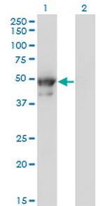 KRT8 Antibody in Western Blot (WB)