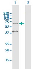 KRT9 Antibody in Western Blot (WB)