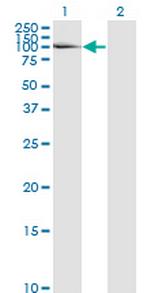 LAMA5 Antibody in Western Blot (WB)