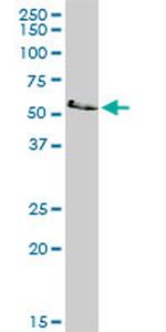 LCK Antibody in Western Blot (WB)