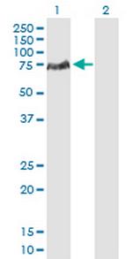 LCP2 Antibody in Western Blot (WB)