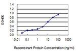 LCT Antibody in ELISA (ELISA)