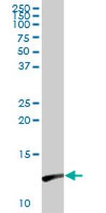 LGALS1 Antibody in Western Blot (WB)