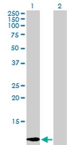 LGALS1 Antibody in Western Blot (WB)