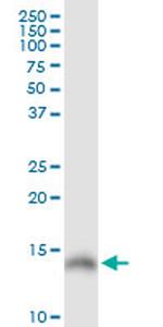 LGALS1 Antibody in Western Blot (WB)