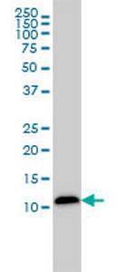 LGALS1 Antibody in Western Blot (WB)