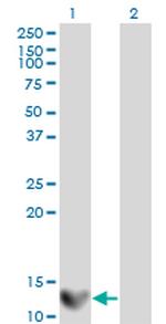 LGALS1 Antibody in Western Blot (WB)