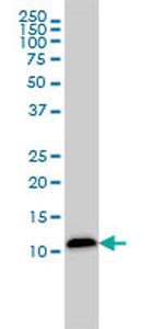 LGALS1 Antibody in Western Blot (WB)