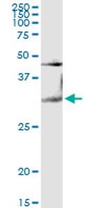 LGALS3 Antibody in Western Blot (WB)