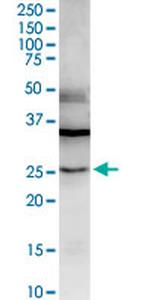 LGALS3 Antibody in Western Blot (WB)