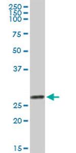 LGALS3 Antibody in Western Blot (WB)