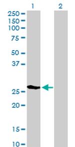 LGALS3 Antibody in Western Blot (WB)