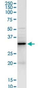 LGALS3 Antibody in Western Blot (WB)