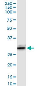 LGALS3 Antibody in Western Blot (WB)