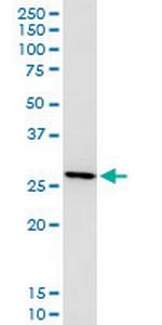 LGALS3 Antibody in Western Blot (WB)