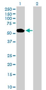 ABLIM1 Antibody in Western Blot (WB)