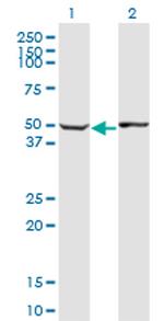 ABLIM1 Antibody in Western Blot (WB)