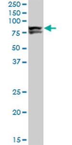 LIMK1 Antibody in Western Blot (WB)