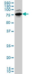 LIMK1 Antibody in Western Blot (WB)