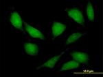 LIMK2 Antibody in Immunocytochemistry (ICC/IF)