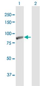 LIMK2 Antibody in Western Blot (WB)