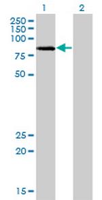 LIMK2 Antibody in Western Blot (WB)