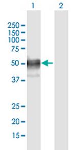 LIPA Antibody in Western Blot (WB)