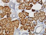 LLGL2 Antibody in Immunohistochemistry (Paraffin) (IHC (P))