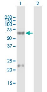 LTBR Antibody in Western Blot (WB)