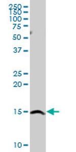 SH2D1A Antibody in Western Blot (WB)