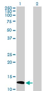 SH2D1A Antibody in Western Blot (WB)