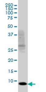 SH2D1A Antibody in Western Blot (WB)