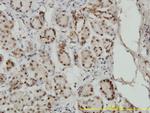 SMAD1 Antibody in Immunohistochemistry (Paraffin) (IHC (P))