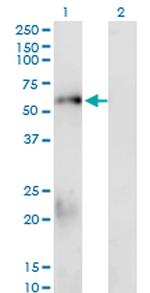 SMAD1 Antibody in Western Blot (WB)